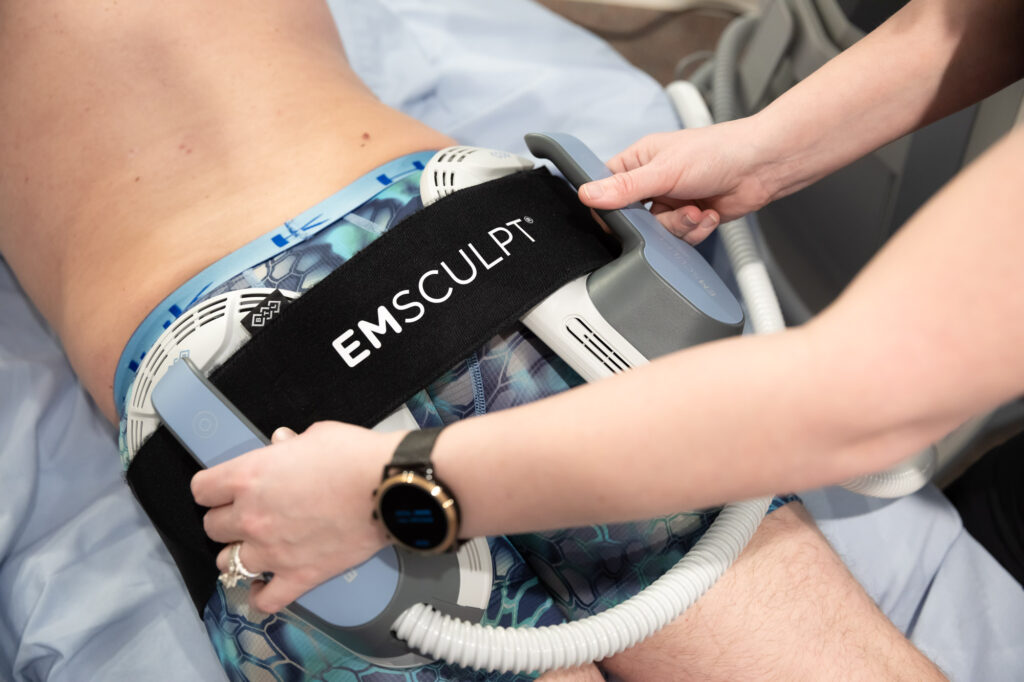 A providers hands placing treatment pads on the butt of a pretty young lady as part of her Emsculpt in Los Angeles