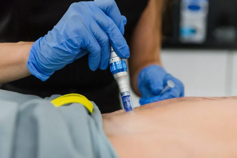 Person performing non-invasive cosmetic procedure with a medical device.