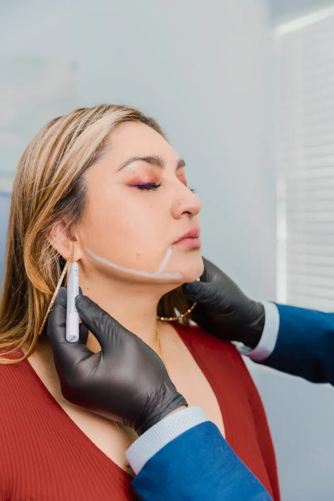 Patient receiving consultation for facial plastic surgery with markings on the jawline.