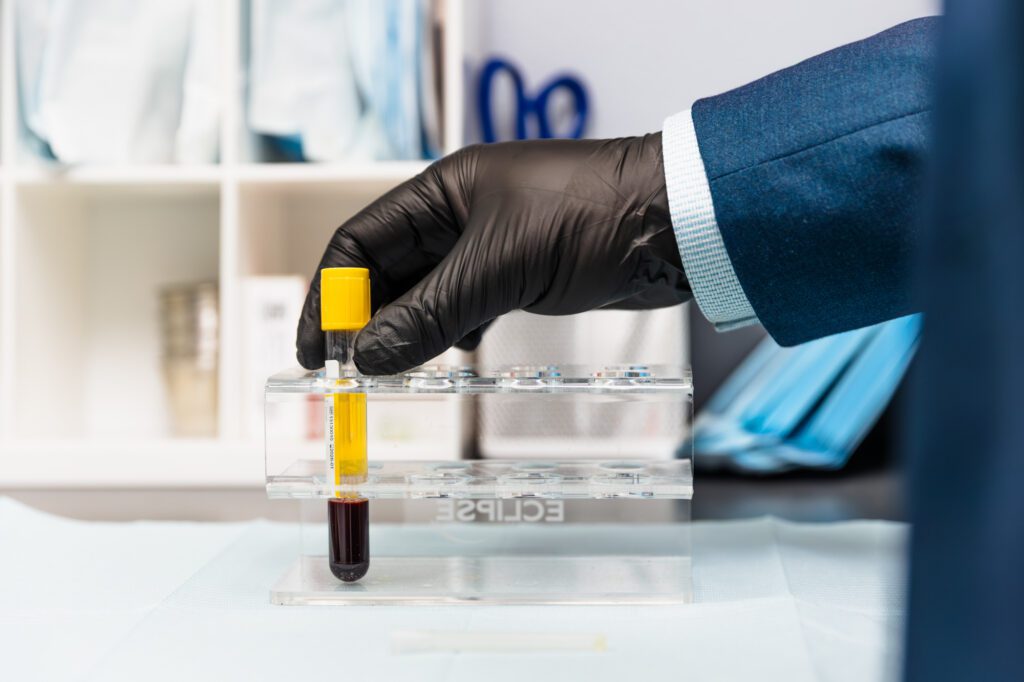 Gloved hand holding a test tube with blood in a medical lab setting.