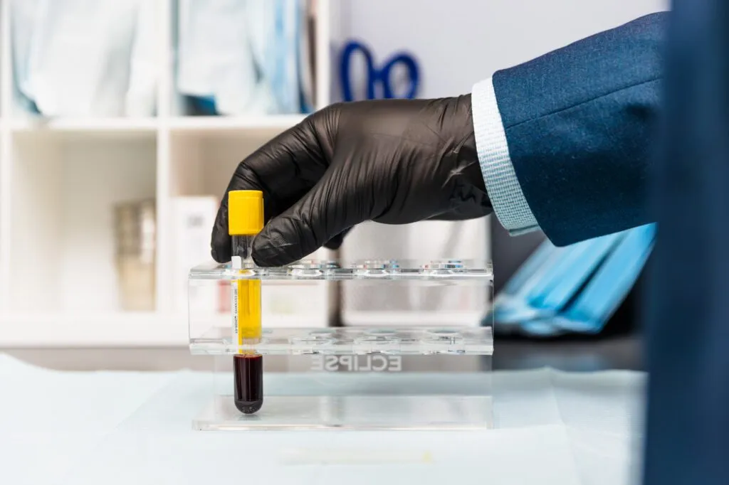 Gloved hand holding a test tube with blood in a medical lab setting.