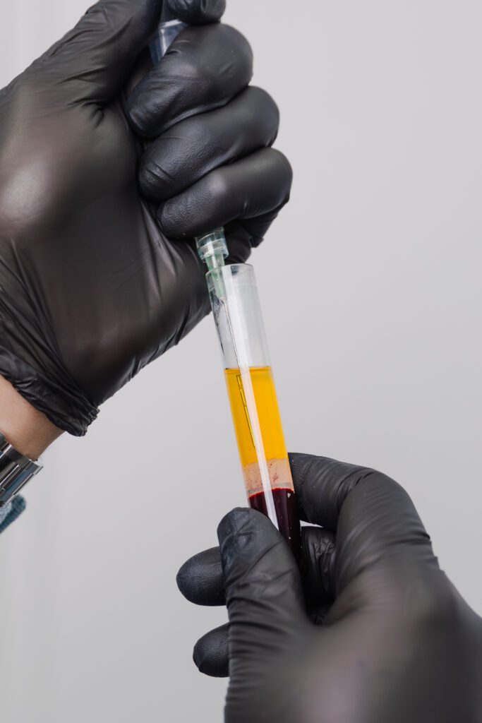 Gloved hands holding a syringe and test tube with separated plasma and red blood cells.