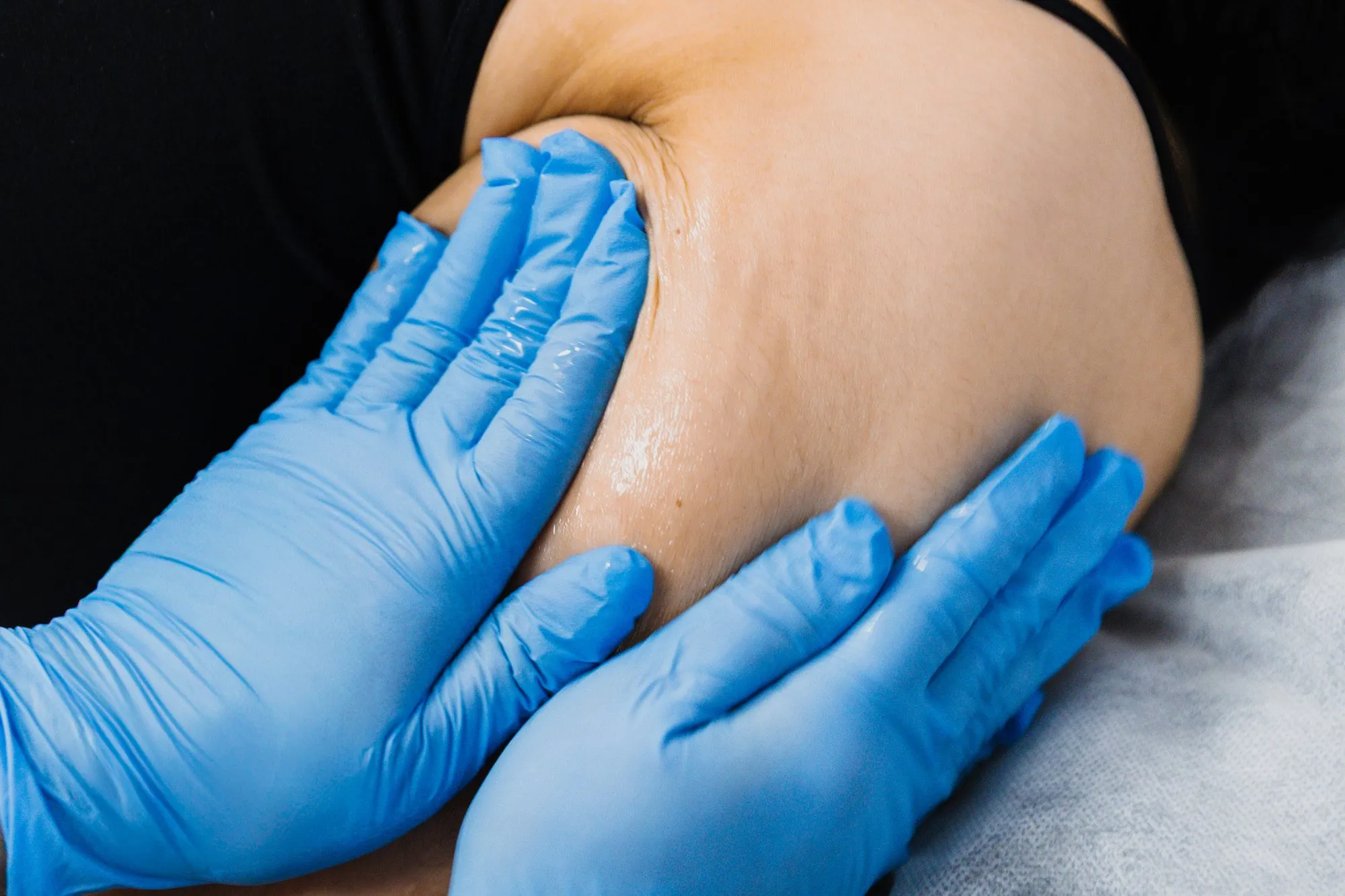 Gloved hands performing a cellulite massage treatment on a woman's thigh.