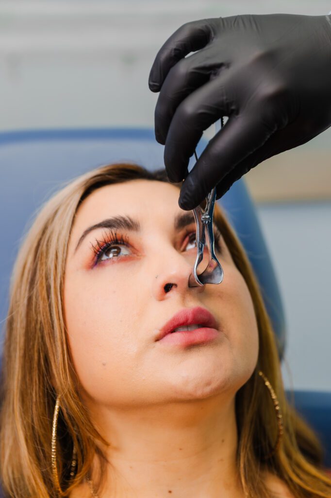 Close-up of a woman receiving a non-surgical nose evaluation with a nasal speculum by a gloved medical professional, during a rhinoplasty consultation at Younique Surgery Center & Medical Spa